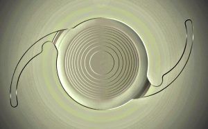 Trifokal Lens