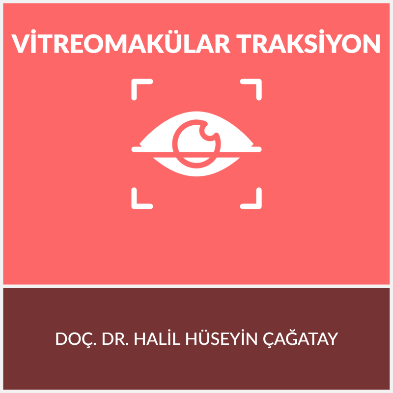 Vitreomakülar Traksiyon