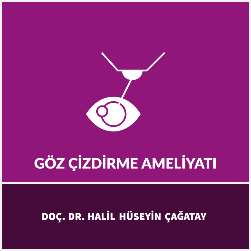 Göz Çizdirme Ameliyatı