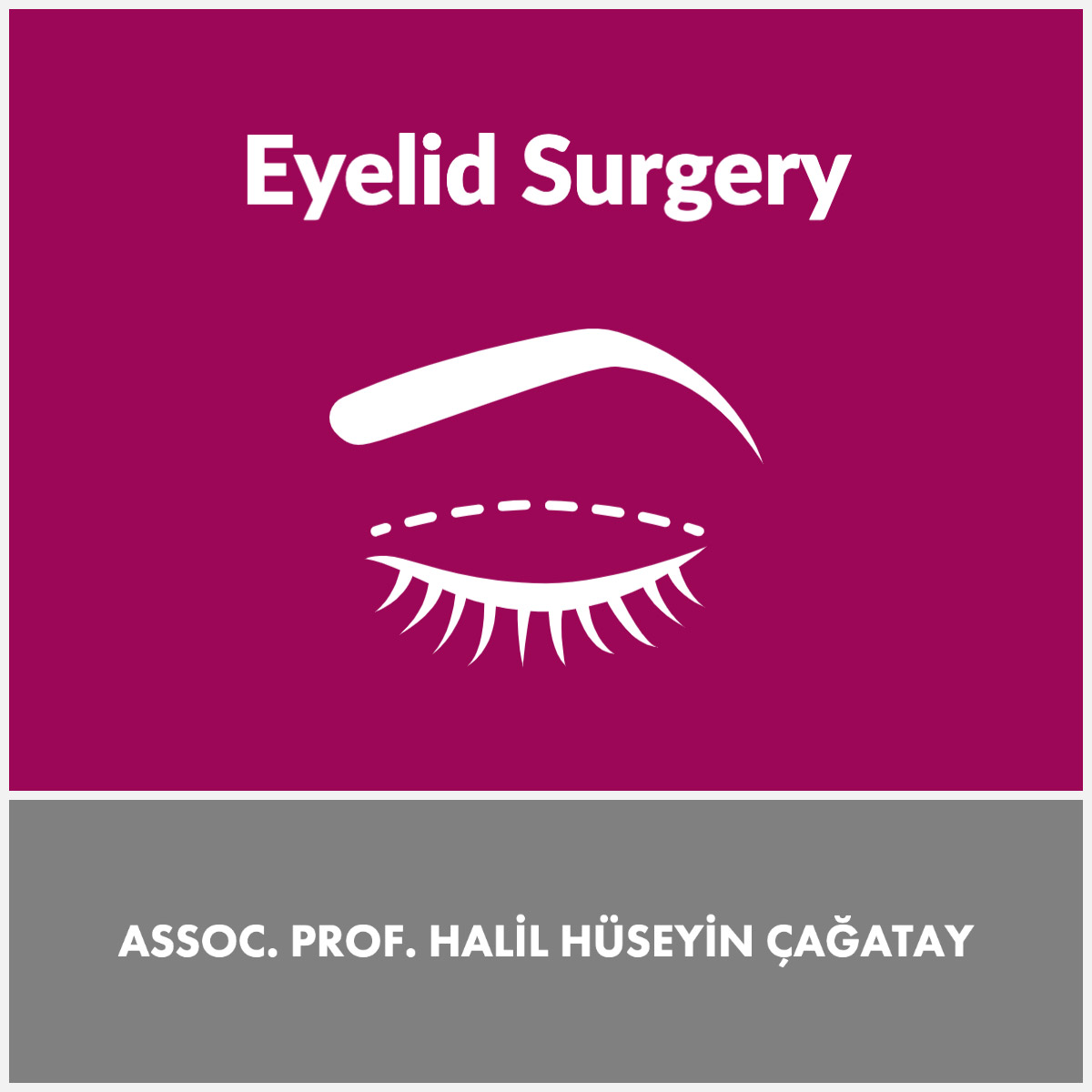 eyelid surgery